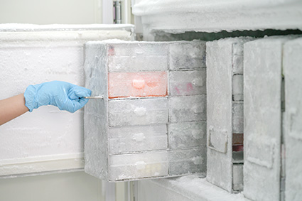 Biobanking Samples